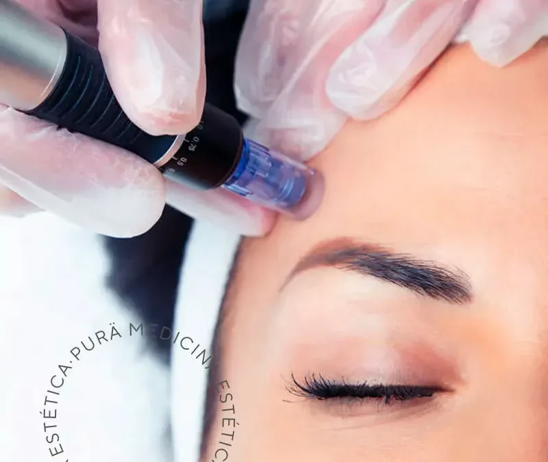 Descubre las Innovaciones con Dermapen Facial en el Evento ANM Estética